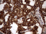 CEA (CEACAM5) Antibody in Immunohistochemistry (Paraffin) (IHC (P))