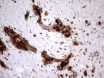 CEA (CEACAM5) Antibody in Immunohistochemistry (Paraffin) (IHC (P))