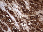 CEA (CEACAM5) Antibody in Immunohistochemistry (Paraffin) (IHC (P))