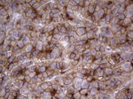 CEA (CEACAM5) Antibody in Immunohistochemistry (Paraffin) (IHC (P))