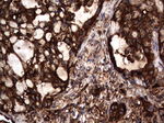 CEA (CEACAM5) Antibody in Immunohistochemistry (Paraffin) (IHC (P))