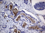 CEA (CEACAM5) Antibody in Immunohistochemistry (Paraffin) (IHC (P))