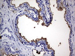 CEA (CEACAM5) Antibody in Immunohistochemistry (Paraffin) (IHC (P))