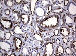 CEA (CEACAM5) Antibody in Immunohistochemistry (Paraffin) (IHC (P))