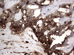 CEA (CEACAM5) Antibody in Immunohistochemistry (Paraffin) (IHC (P))