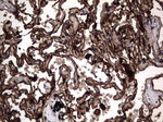 CEA (CEACAM5) Antibody in Immunohistochemistry (Paraffin) (IHC (P))