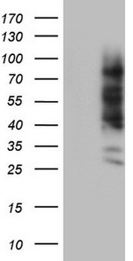 CEA (CEACAM5) Antibody in Western Blot (WB)