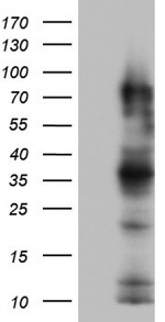 CEA (CEACAM5) Antibody in Western Blot (WB)