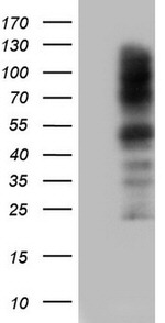 CEA (CEACAM5) Antibody in Western Blot (WB)