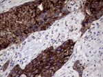CEACAM6 Antibody in Immunohistochemistry (Paraffin) (IHC (P))