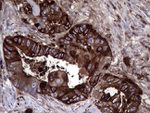 CEACAM6 Antibody in Immunohistochemistry (Paraffin) (IHC (P))