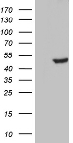 CELF6 Antibody in Western Blot (WB)