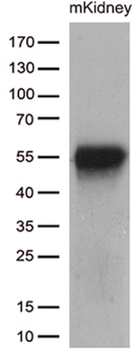 CELF6 Antibody in Western Blot (WB)