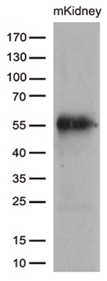 CELF6 Antibody in Western Blot (WB)