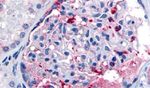 CELSR1 Antibody in Immunohistochemistry (Paraffin) (IHC (P))