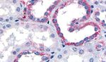 CELSR1 Antibody in Immunohistochemistry (Paraffin) (IHC (P))