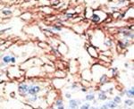 APOBEC3G Antibody in Immunohistochemistry (IHC)