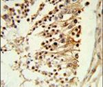 CENPH Antibody in Immunohistochemistry (IHC)
