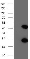 CENPH Antibody in Western Blot (WB)