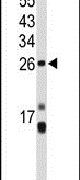CENPH Antibody in Western Blot (WB)