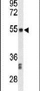 CENPI Antibody in Western Blot (WB)