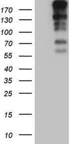 CENPJ Antibody in Western Blot (WB)