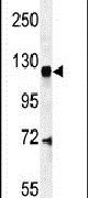 CENTG1 Antibody in Western Blot (WB)