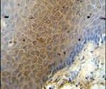 BITE Antibody in Immunohistochemistry (IHC)
