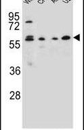 BITE Antibody in Western Blot (WB)