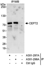CEP72 Antibody in Immunoprecipitation (IP)