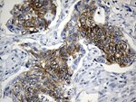 CEP72 Antibody in Immunohistochemistry (Paraffin) (IHC (P))