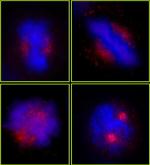 CEP78 Antibody in Immunocytochemistry (ICC/IF)