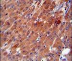 CES2 Antibody in Immunohistochemistry (IHC)