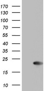 CETN1 Antibody in Western Blot (WB)