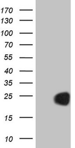 CETN3 Antibody in Western Blot (WB)