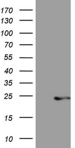 CETN3 Antibody in Western Blot (WB)