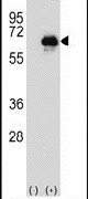 CETP Antibody in Western Blot (WB)