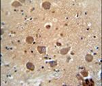 C6orf62 Antibody in Immunohistochemistry (IHC)