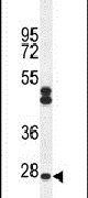 C6orf62 Antibody in Western Blot (WB)