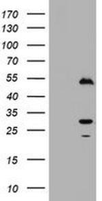 Timer Antibody in Western Blot (WB)