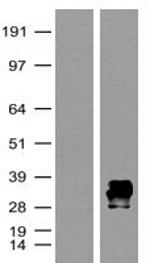 mKate Antibody in Western Blot (WB)
