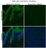 pan Cytokeratin (pan CK) Antibody in Immunohistochemistry (Paraffin) (IHC (P))