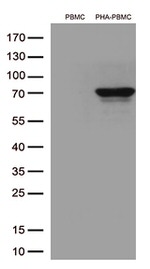 Lymphocyte Activation Gene 3 (LAG3) Antibody in Western Blot (WB)