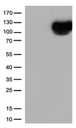 CD10 (MME) Antibody in Western Blot (WB)