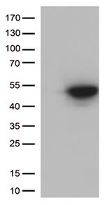 CDK15 Antibody in Western Blot (WB)