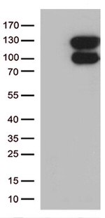 VPS50 Antibody in Western Blot (WB)