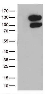 VPS50 Antibody in Western Blot (WB)