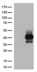TIGIT Antibody in Western Blot (WB)
