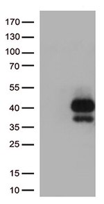 TIGIT Antibody in Western Blot (WB)