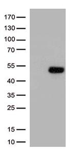ATF4 Antibody in Western Blot (WB)